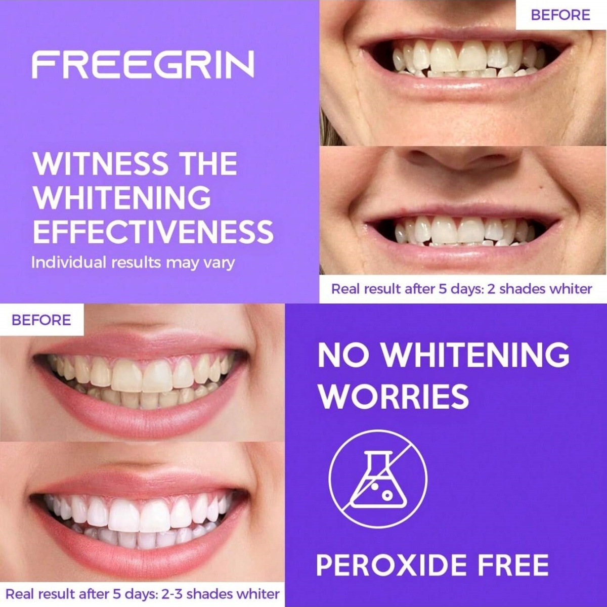 Deluxe Whitening Teeth Sticker - đánh giá và giá Teeth Whitening Near Me